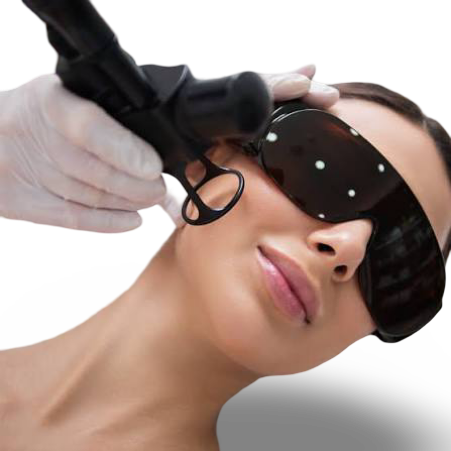 CO2 FRACTIONAL LASER - ACNE SCARS