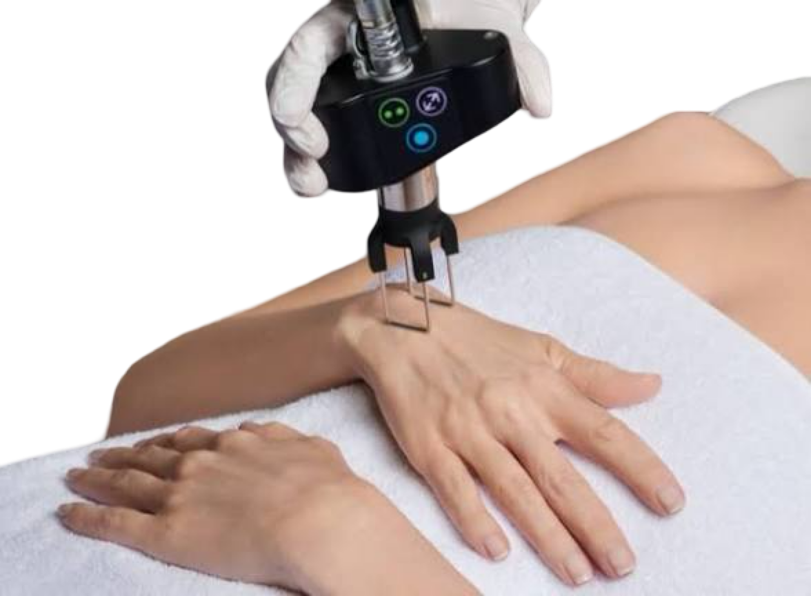 CO2 FRACTIONAL LASER - HAND REJUVENATION